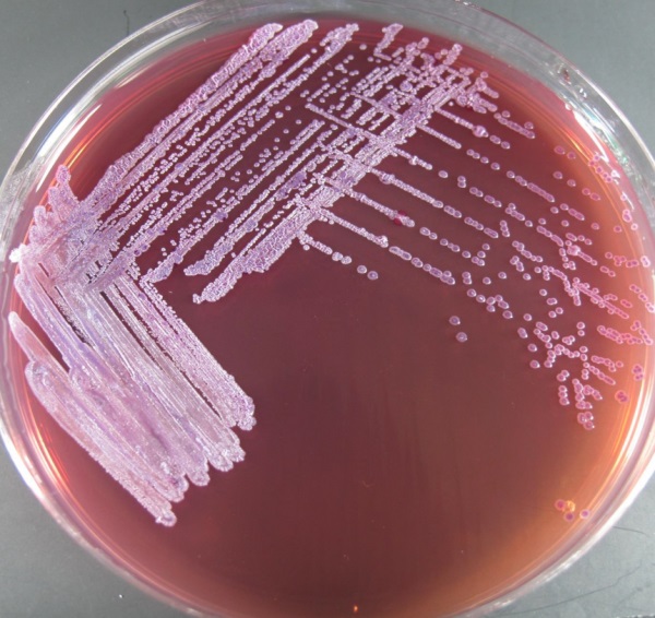 Bacterial cells in a petrie dish
